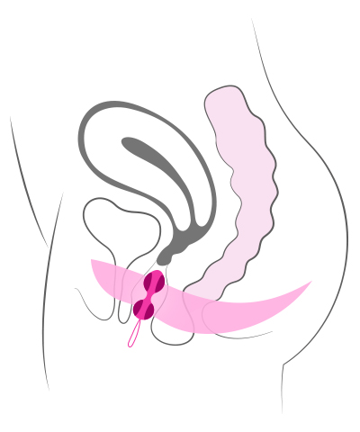 Proper placement of kegel balls assures the full benefits of kegel exercises.